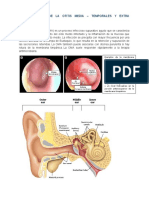 Complicaciones de La Otitis Media - Resumen