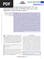 Successfully Managing Impending Skin Necrosis Following Hyaluronic Acid Filler Injection, Using High-Dose Pulsed Hyaluronidase