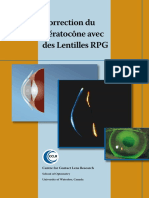 Correction of Keratoconus FR