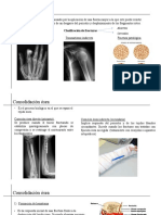 Tejido Óseo - Fracturas