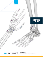 Acumed SurgicalTechnique Spanish Acutrak2 ESSPF00 02 A