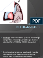 Herniile Diafragmatice