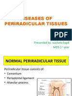 Diseases of Periradicular Tissues