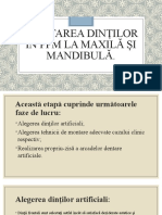 Montarea Dinților În PPM