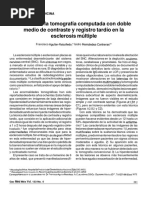 Utilidad de La Tomografía Computada Con Doble Medio de Contraste Registro Tardío en Esclerosis Múltiple