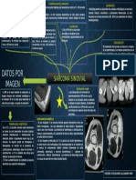 Sarcoma Sinovial