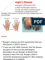 Burgers Disease