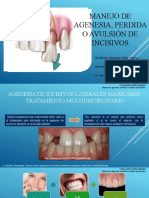 Manejo de Agenesia, Perdida o Avulsión de