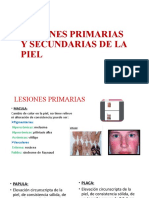 Lesiones Primarias y Secundarias de La Piel