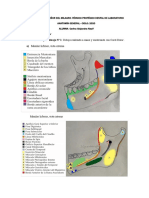 tp1 y 2 Maxilar Inferior