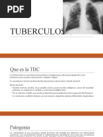 Tuberculosis