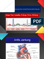 Interpretasi EKG