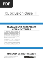 TX Oclusión Clase III