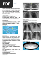 Radiografía Tórax