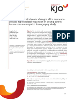 Skeletal and Dentoalveolar Changes After Miniscrew-Assisted Rapid Palatal Expansion in Young Adults: A Cone-Beam Computed Tomography Study