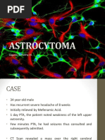 Astrocytoma: Zagada, Timothy M