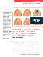 1 La Planificación Protésica en Prótesis Fijas y Removibles Combinadas