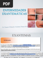 Exantemas