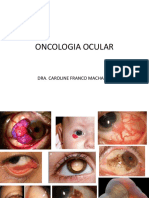 AULA 2 - Oncologia Ocular