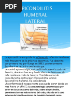 Hipocondilitis Humeral Lateral