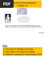 Chapter 11-The Normal Electrocardiogram