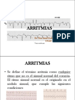 ARRITMIAS