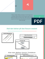 Alat Dan Bahan Pit and Fissure Sealant