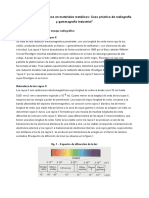 Ensayos No Destructivos en Materiales Metálicos: Caso Práctico de Radiografía y Gammagrafía Industrial