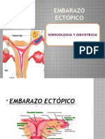 Embarazo Ectopico