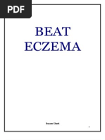 Beat Eczema: Susan Clark