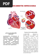 Endocarditis Infecciosa