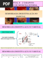 Hda No Variceal