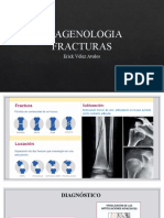 Imagenologia Fracturas