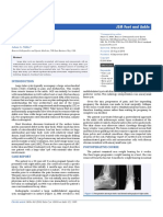 Talar Cyst: JSM Foot and Ankle