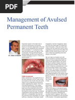 Management of Avulsed