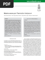 Malaria Severa Por Plasmodium Falciparum