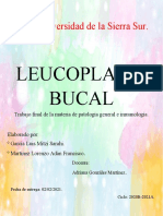 Leucoplasia Bucal