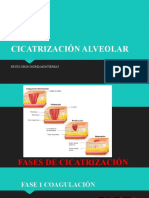 Cicatrización Alveolar