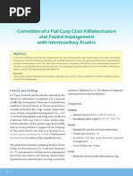 Correction of A Full Cusp Class II Malocclusion and Palatal Impingement With Intermaxillary Elastics