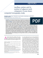 Impaction of Maxillary Canines and Its Effect On The Position of Adjacent Teeth and Canine Development: A Cone-Beam Computed Tomography Study