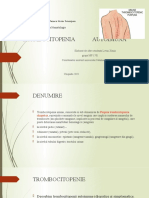 Trombocitopenie Autoimuna