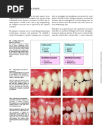 Dynamic Occlusion: 130 Manual Functional Analysis