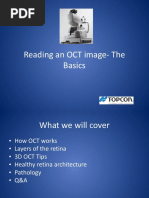 Reading An OCT Image-The Basics