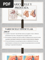 Varicocele y Próstata