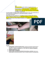 Caso Clinico de Celulitis Pediatria