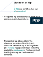 Congenital-Torticollis (Wry Neck)