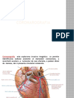 Ciubotaru Diana-Maria, Coronarografie