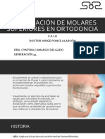 6.distalización de Molares Superiores en Ortodoncia