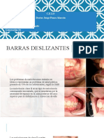 9.barras Deslizantes