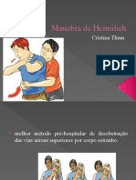 Manobra de Heimilich